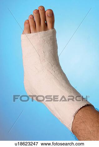 ankle, break, bandages, aid View Large Photo Image Stock Photo - ankle, break, bandages, aid. Fotosearch