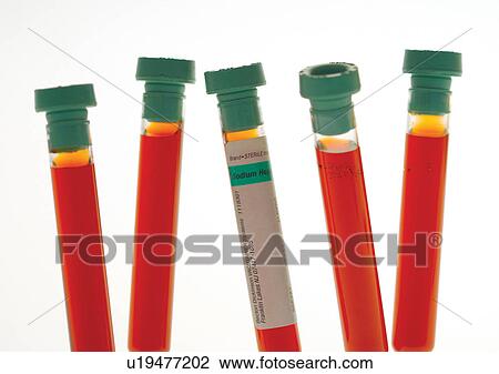 Stock Image - beaker, cap, blood, analysis. Fotosearch