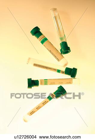 Picture - beaker, chemistry, chemical, analysis. Fotosearch