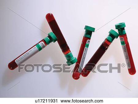 Stock Image - beaker, chemistry, chemical, analysis. Fotosearch
