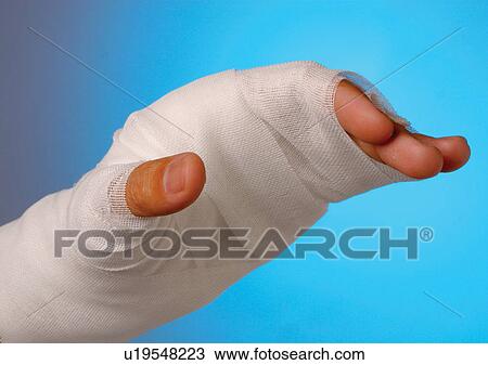Stock Image - bind, covered, brace, arm. Fotosearch