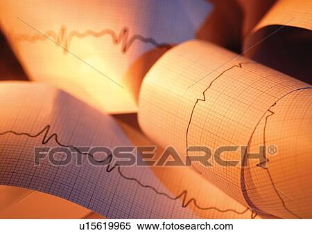 Stock Photography - biology, lab, ecg, graph. Fotosearch