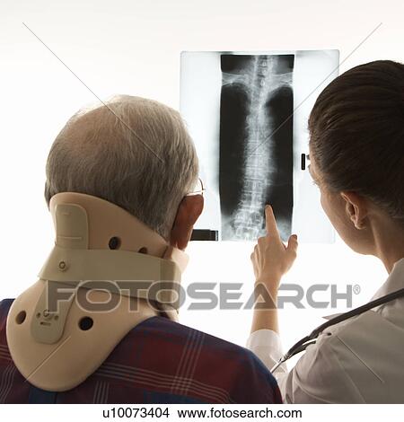 Over the shoulders view of mid-adult Caucasian female pointing at an x-ray as elderly Caucasian male in neck brace looks on. View Large Photo Image Picture - Over the shoulders view of mid-adult Caucasian female pointing at an x-ray as elderly Caucasian male in neck brace looks on.. Fotosearch