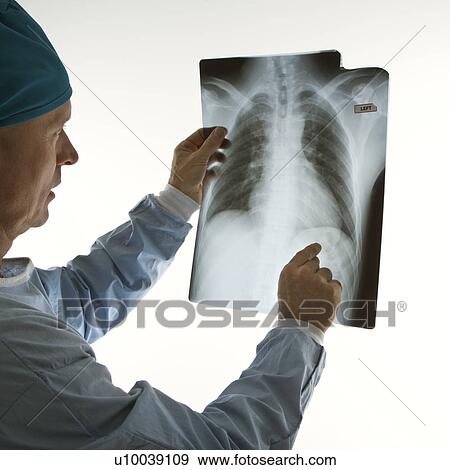 Stock Photo - Mid-adult Caucasian male doctor pointing at an x-ray.. Fotosearch