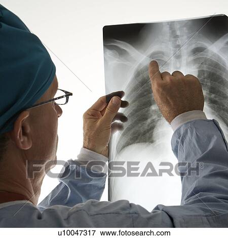 Mid-adult Caucasian male doctor pointing at a bone on a x-ray. View Large Photo Image Stock Photo - Mid-adult Caucasian male doctor pointing at a bone on a x-ray.. Fotosearch