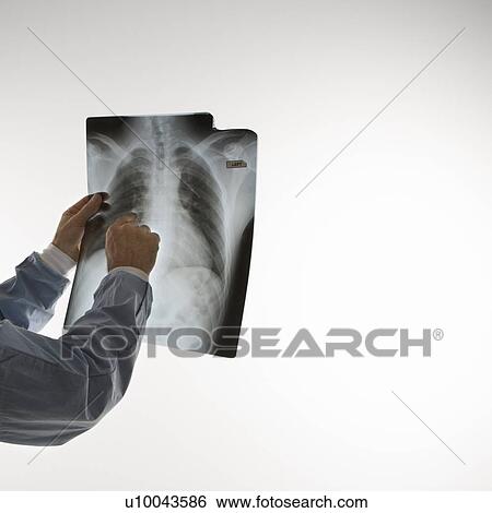 Stock Photograph - Mid-adult Caucasian male doctor pointing at an x-ray.. Fotosearch
