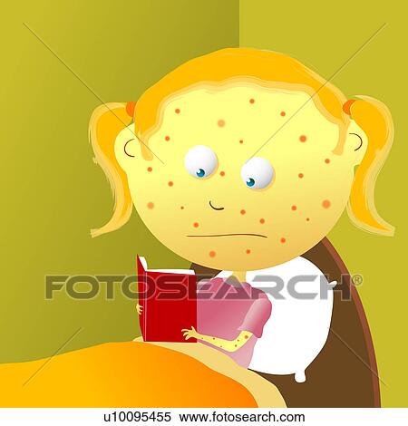 Stock Illustration - Close-up of a girl with red spots on her face and reading a book. Fotosearch