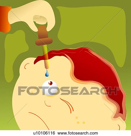 Person's hand putting eye drops into a boy's eye View Large Illustration Stock Illustration - Person's hand putting eye drops into a boy's eye. Fotosearch