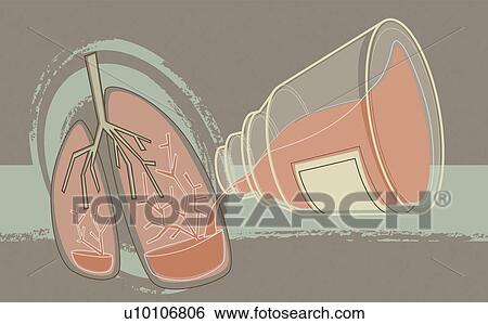 Stock Illustration - Blood pouring from a bottle into human lungs. Fotosearch