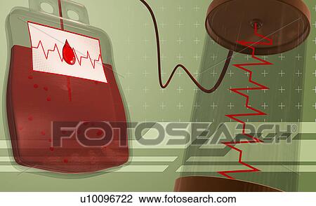 Close-up of a blood bag View Large Illustration Drawing - Close-up of a blood bag. Fotosearch