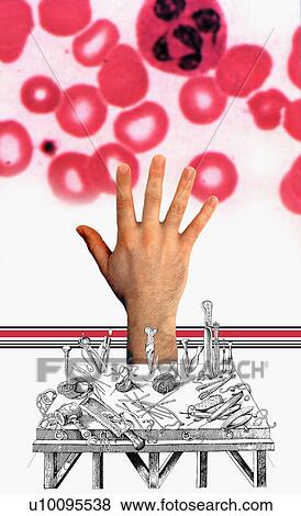 Stock Illustration - Close-up of a human hand surrounded by diagrams of surgical tools. Fotosearch