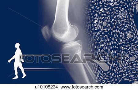 Stock Illustration - Close-up of a human joint. Fotosearch