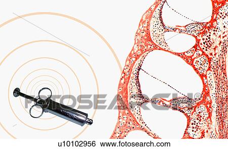 Stock Illustration - Close-up of a syringe. Fotosearch