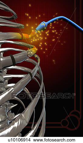 Close-up of a welding torch welding human bones View Large Illustration Stock Illustration - Close-up of a welding torch welding human bones. Fotosearch