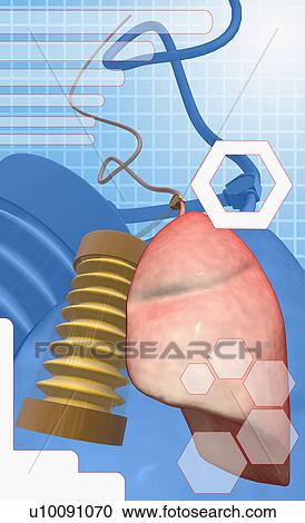 Close-up of artificial pumps and a human kidney View Large Illustration Clipart - Close-up of artificial pumps and a human kidney. Fotosearch