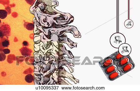 Close-up of the human spine and a blister pack View Large Illustration Stock Illustration - Close-up of the human spine and a blister pack. Fotosearch