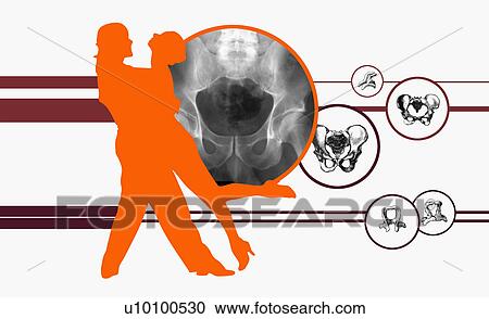 Clipart - Side profile of a couple dancing superimposed on diagrams of human bones. Fotosearch