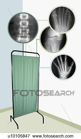 Stock Illustration - X-Ray images over a hospital screen. Fotosearch