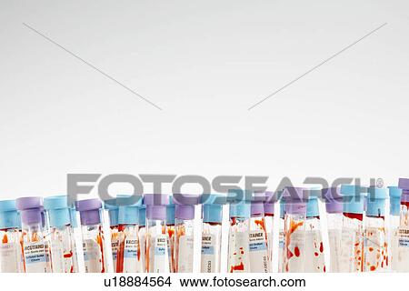 Blood samples in test tubes (close-up) View Large Photo Image Picture - Blood samples in test tubes (close-up). Fotosearch