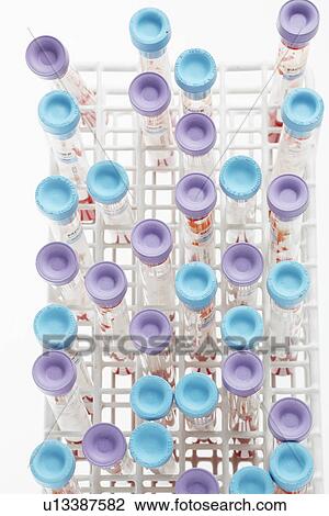 Blood samples in test tubes (close-up) View Large Photo Image Stock Image - Blood samples in test tubes (close-up). Fotosearch
