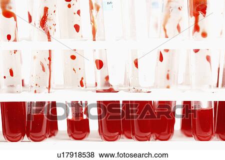 Blood samples in test tubes (close-up) View Large Photo Image Stock Photo - Blood samples in test tubes (close-up). Fotosearch