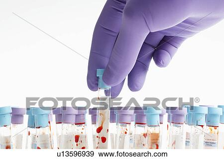 Hand holding blood sample in test tube (close-up) View Large Photo Image Stock Photo - Hand holding blood sample in test tube (close-up). Fotosearch