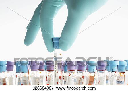 Hand holding blood sample in test tube (close-up) View Large Photo Image Stock Photo - Hand holding blood sample in test tube (close-up). Fotosearch