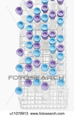 Stock Image - Test tubes in rack (high angle view). Fotosearch