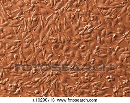 Electronic Microscopic image of Malignant Melanoma Cells, Full Frame, close up View Large Photo Image Stock Image - Electronic Microscopic image of Malignant Melanoma Cells, Full Frame, close up. Fotosearch