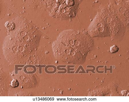 Electronic Microscopic image of Embryonic Stem Cells, Full Frame, close up View Large Photo Image Stock Photo - Electronic Microscopic image of Embryonic Stem Cells, Full Frame, close up. Fotosearch