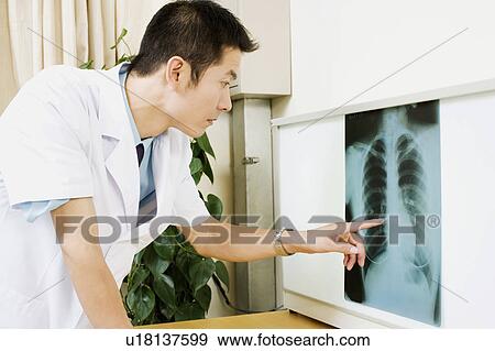 Stock Photo - Close-up of a male doctor pointing to an X-Ray. Fotosearch