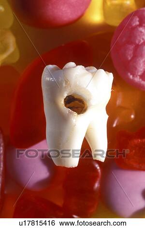 Bernhard, candy, calories, affection View Large Photo Image Stock Photograph - Bernhard, candy, calories, affection. Fotosearch