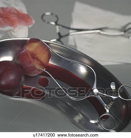Stock Image - blood, bowl, CLOSE, close-up, dish, health. Fotosearch