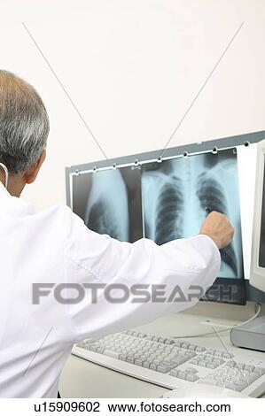 Doctor looking at X-ray View Large Photo Image Stock Image - Doctor looking at X-ray. Fotosearch