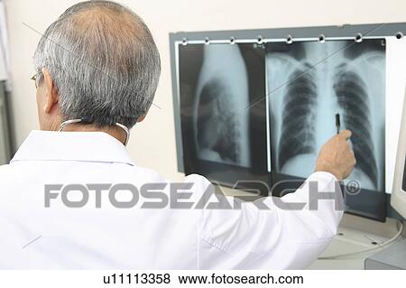 Physician explaining an X-ray View Large Photo Image Stock Photo - Physician explaining an X-ray. Fotosearch