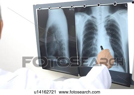 X-ray View Large Photo Image Stock Image - X-ray. Fotosearch
