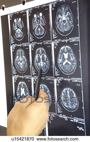 X-ray View Large Photo Image Stock Image - X-ray. Fotosearch