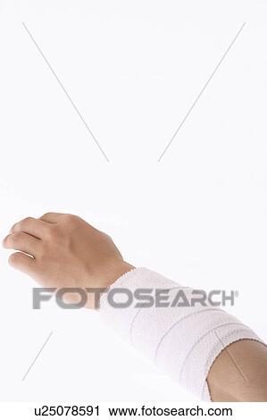 Stock Image - Arm rolled up by bandage. Fotosearch