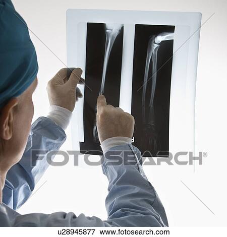 Stock Photo - Mid-adult Caucasian male doctor pointing at an x-ray.. Fotosearch
