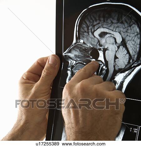 Mid-adult Caucasian male hands pointing at an x-ray. View Large Photo Image Stock Photo - Mid-adult Caucasian male hands pointing at an x-ray.. Fotosearch