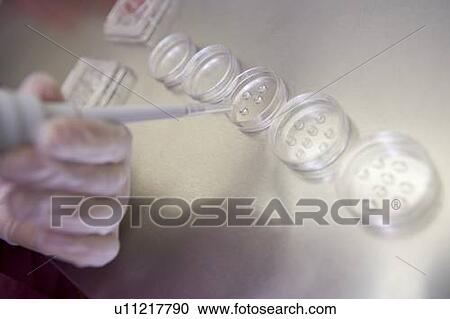 Stock Image - Embryologist adding sperm to egg. Fotosearch