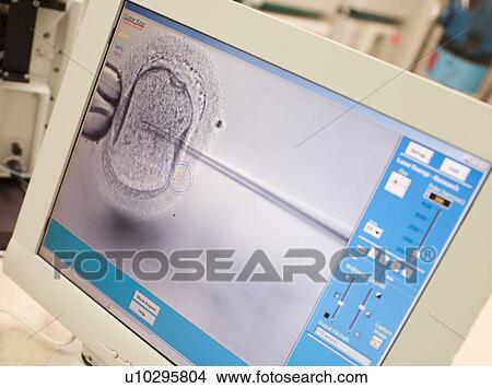 Picture - Monitor showing an intra cytoplasmic sperm injection (selective focus). Fotosearch