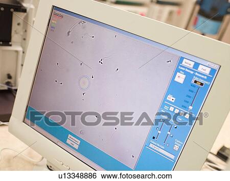 Stock Photograph - Monitor showing an intra cytoplasmic sperm injection (selective focus). Fotosearch