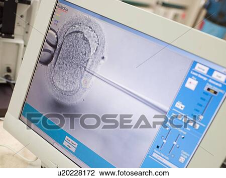 Stock Image - Monitor showing intra cytoplasmic sperm injection (selective focus). Fotosearch