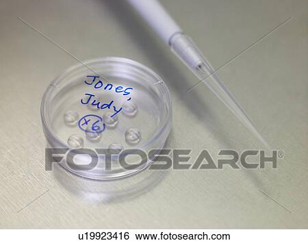 Stock Photograph - Petri dish with fertilised eggs. Fotosearch