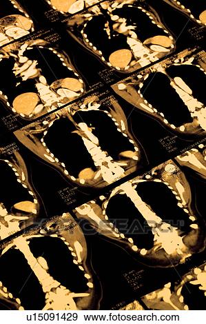 "CAT scan of human chest, close-up" View Large Photo Image Stock Photo - "CAT scan of human chest, close-up". Fotosearch