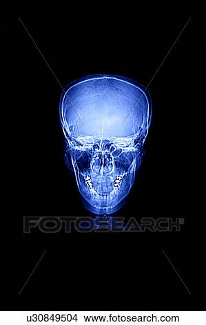 Picture - "CAT scan of human head, close-up". Fotosearch