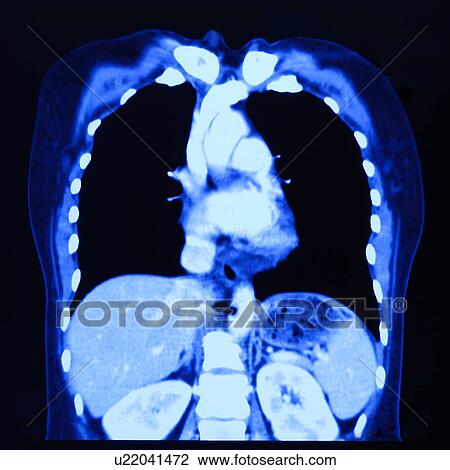Stock Image - "CAT scan of human head, close-up". Fotosearch