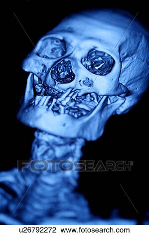 "CAT scan of human head, close-up" View Large Photo Image Stock Image - "CAT scan of human head, close-up". Fotosearch
