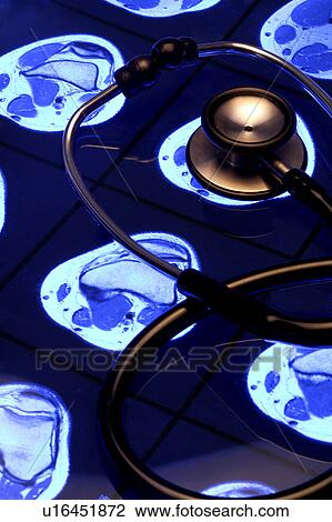 Stock Image - Close-up of a stethoscope. Fotosearch